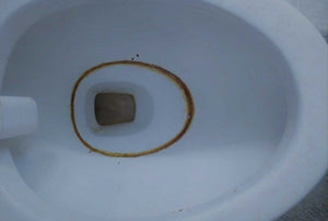 How to Get Rid of Toilet Ring: The Easiest and Most Effective Ways